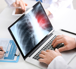 "אין מכשול שלא אעבור - גם את סרטן הריאה" -תמונה